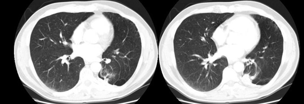 Radiograph 1 from archived case 1