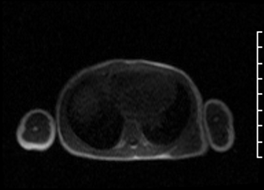 Radiograph 3 from archived case 107