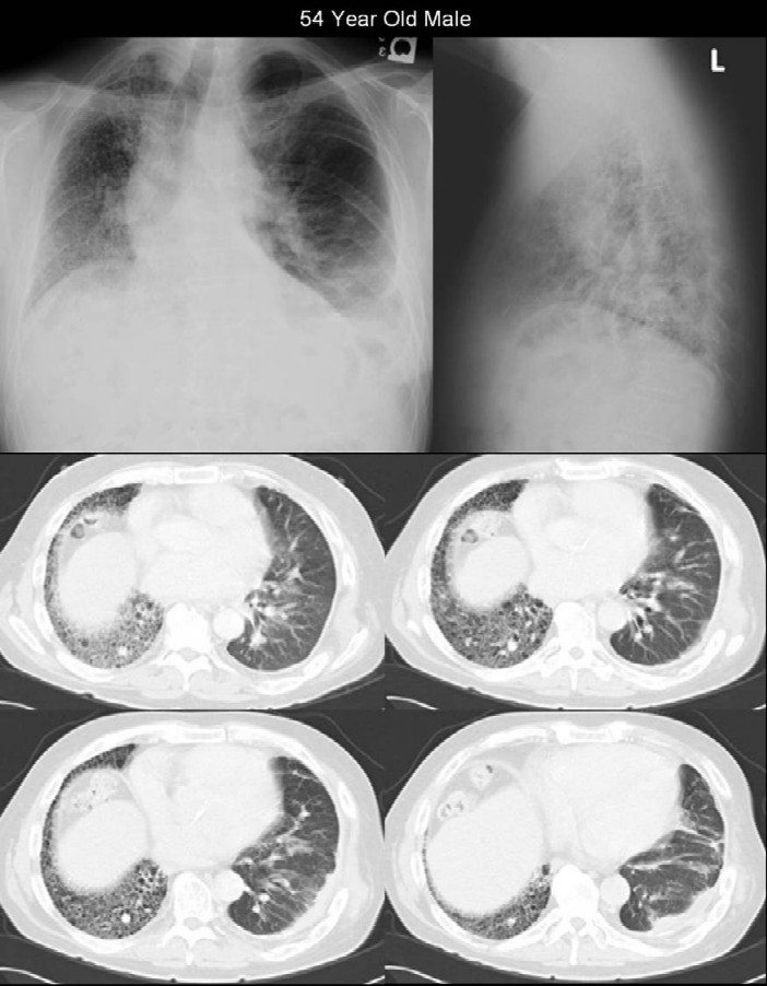Radiograph 5 from archived case 1