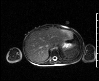 Radiograph 4 from archived case 107
