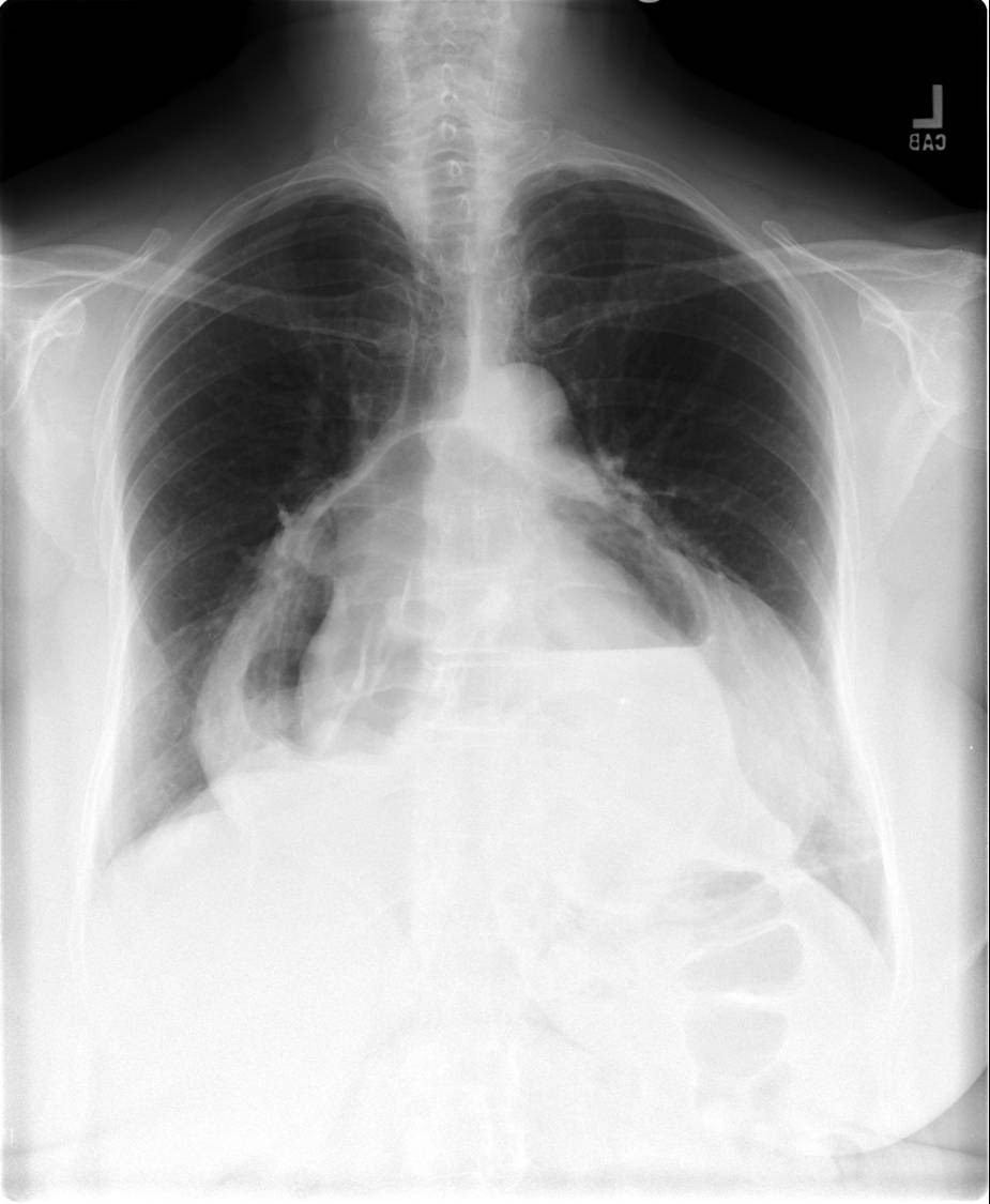 Radiograph 1 from archived case 19