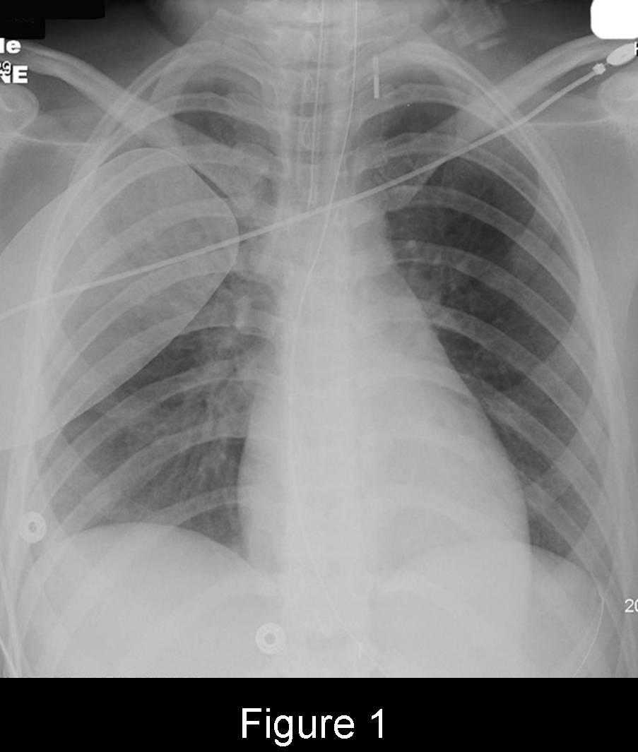 Radiograph 1 from archived case 53