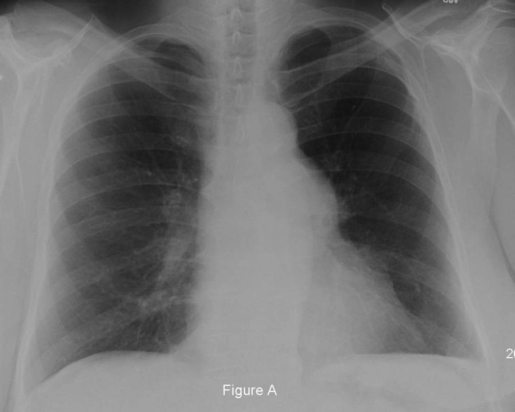 Radiograph 1 from archived case 46