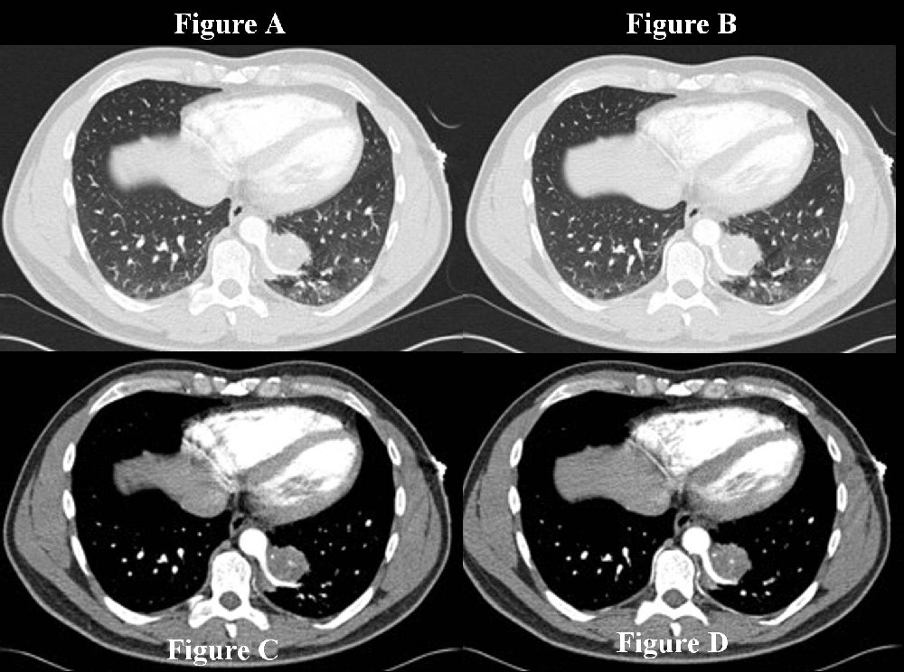 Radiograph 1 from archived case 18