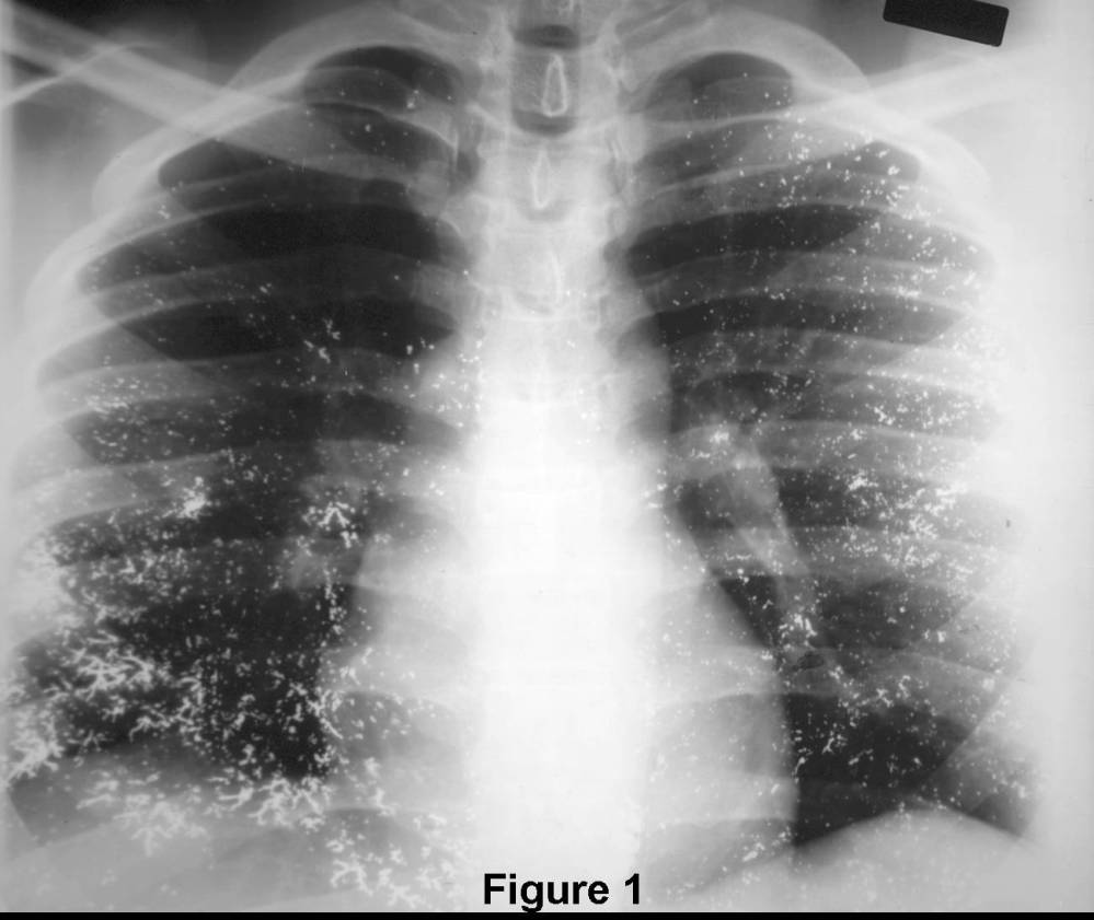 Radiograph 1 from archived case 80