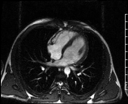 Radiograph 1 from archived case 73