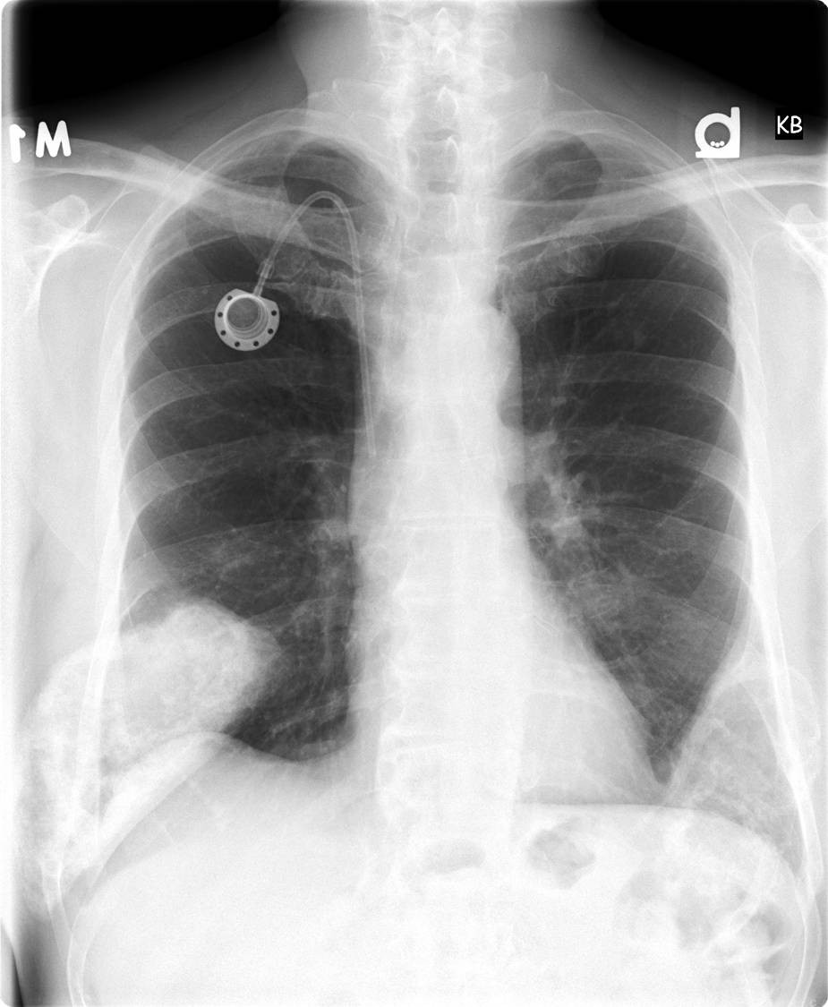 Radiograph 1 from archived case 9