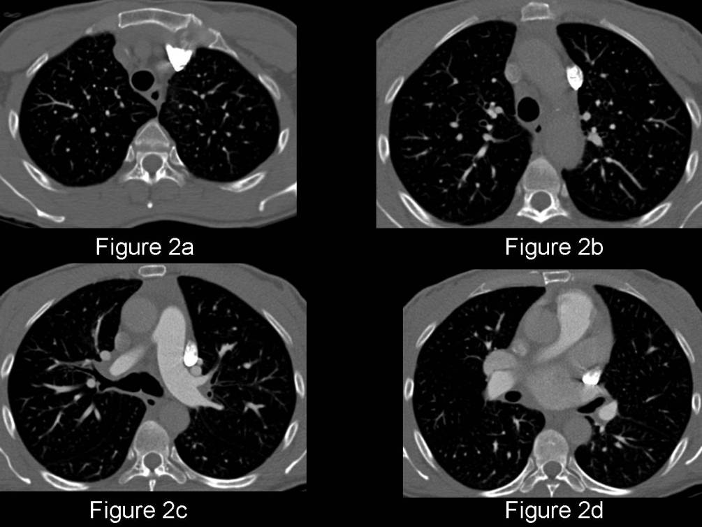 Radiograph 3 from archived case 75