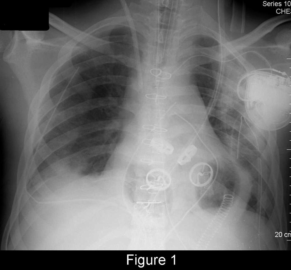 Radiograph 2 from archived case 55