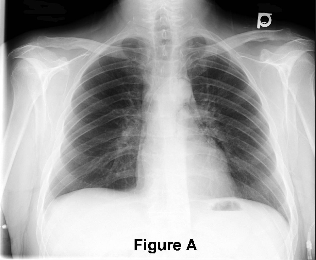 Radiograph 3 from archived case 37