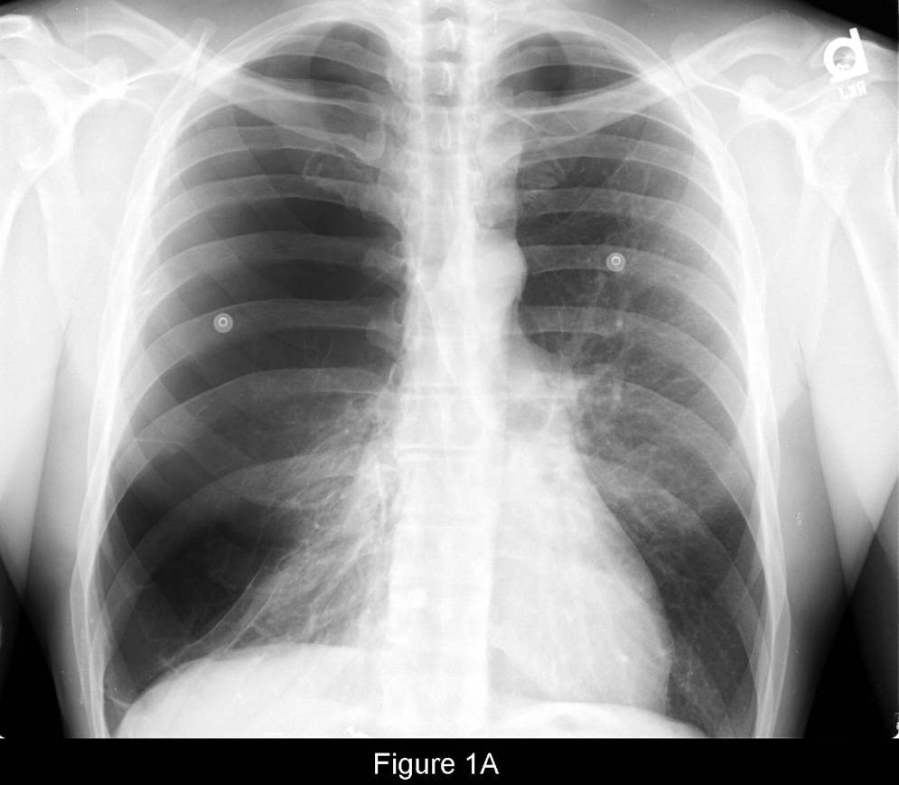 Radiograph 1 from archived case 70