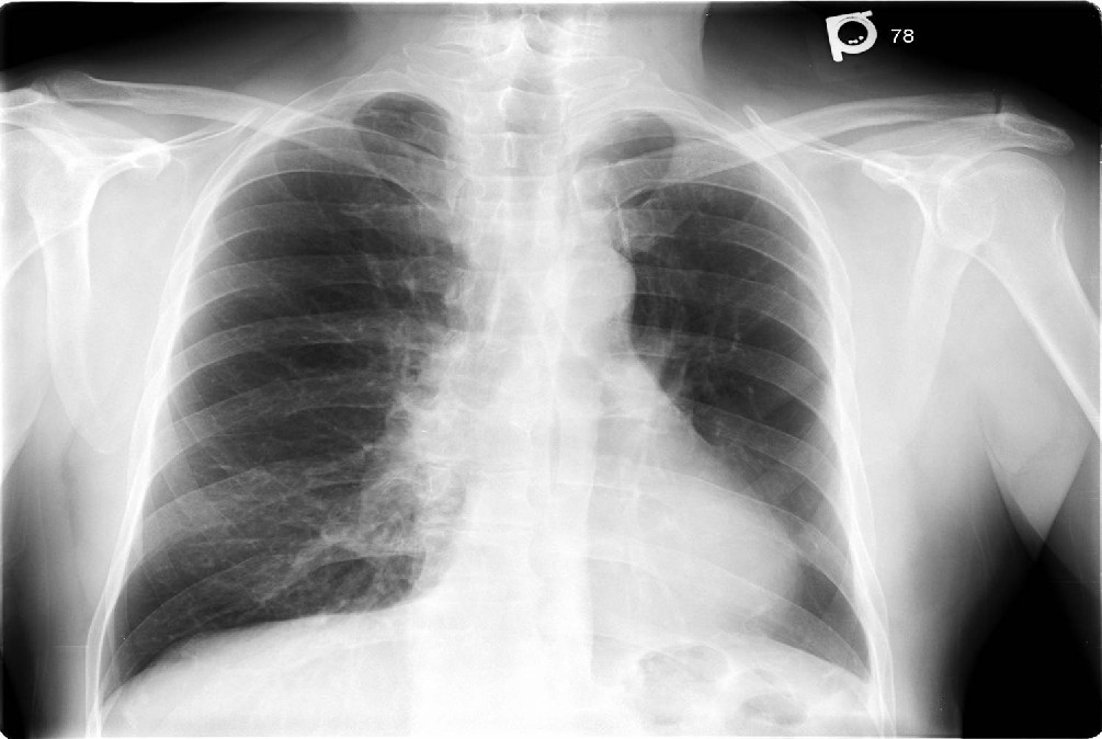 Radiograph 1 from archived case 36