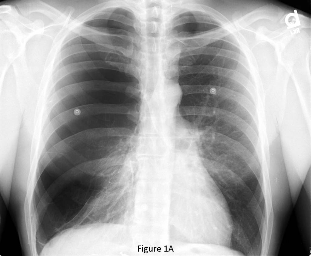 Radiograph 3 from archived case 70