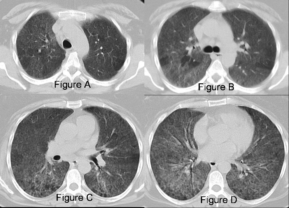 Radiograph 3 from archived case 22