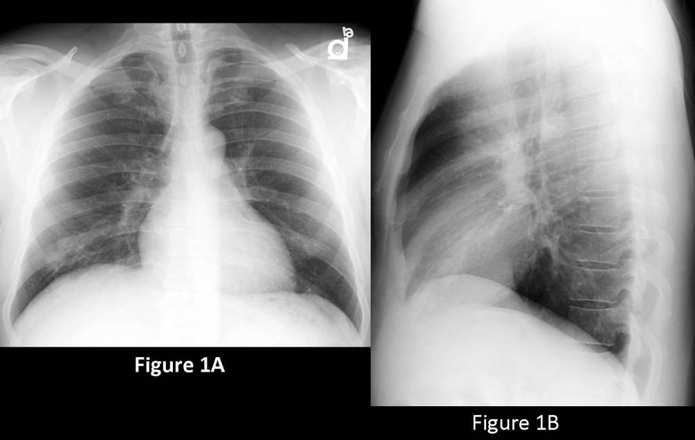 Radiograph 1 from archived case 71