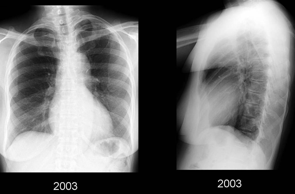 Radiograph 5 from archived case 49
