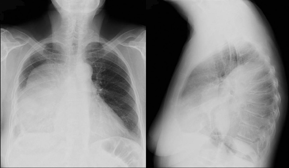 Radiograph 1 from archived case 5