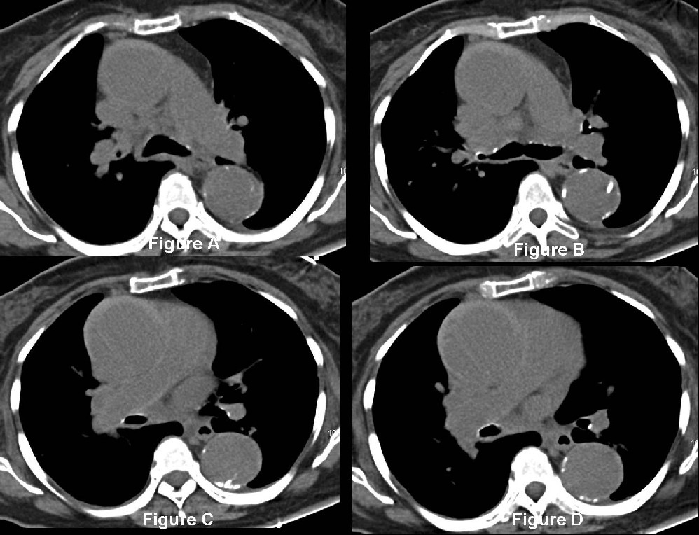 Radiograph 1 from archived case 25