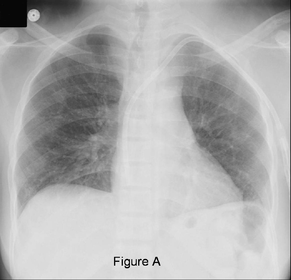 Radiograph 2 from archived case 31