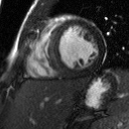 Radiograph 1 from archived case 50