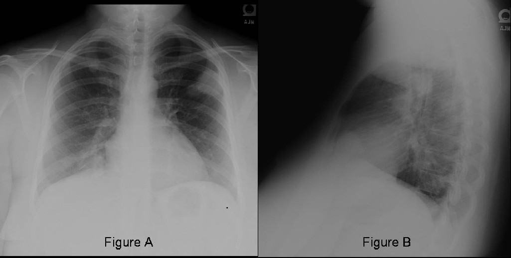 Radiograph 4 from archived case 33