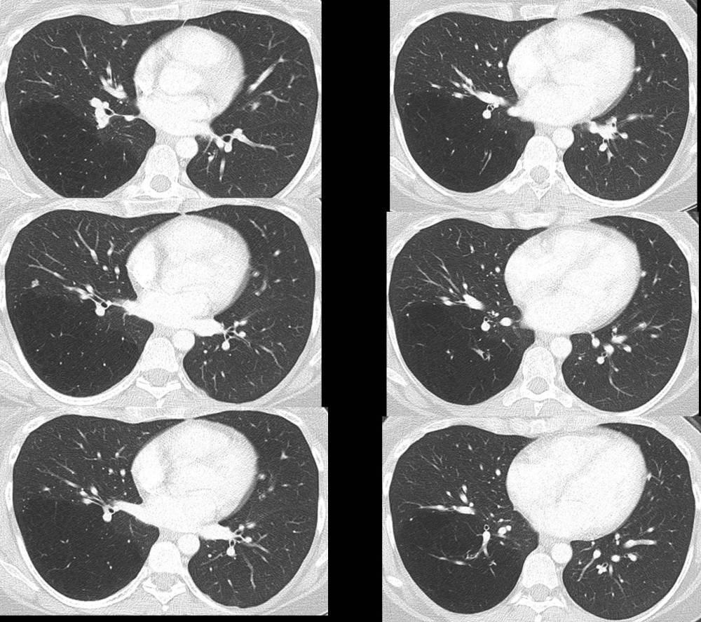 Radiograph 1 from archived case 54