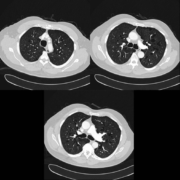 Radiograph 1 from archived case 7