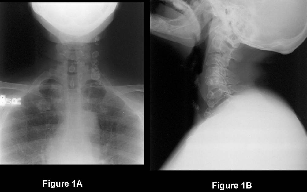 Radiograph 1 from archived case 77