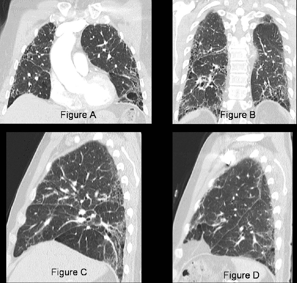 Radiograph 3 from archived case 27