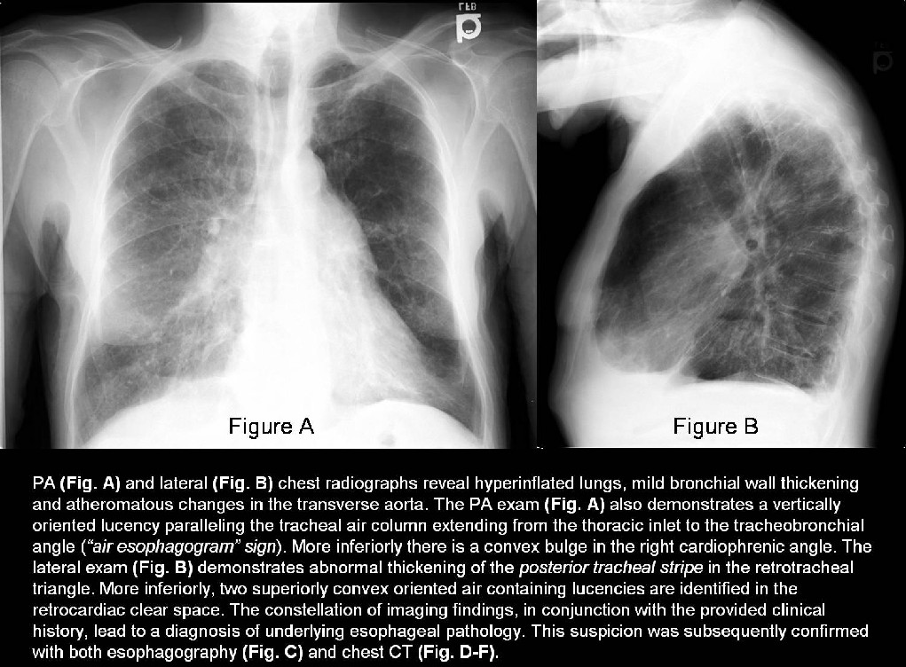 Radiograph 3 from archived case 26