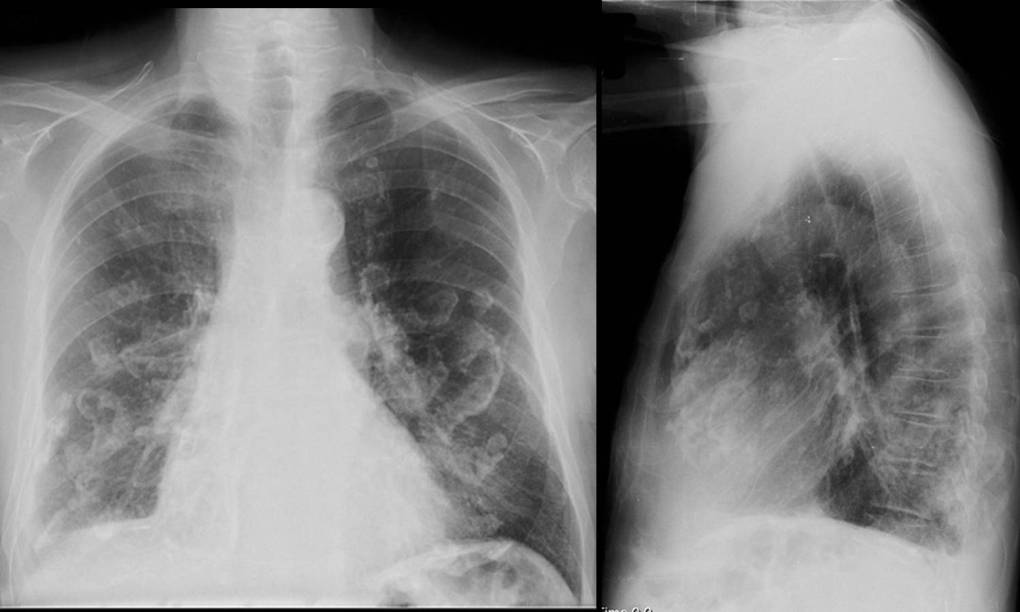 Radiograph 1 from archived case 58