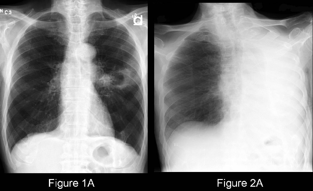 Radiograph 1 from archived case 35
