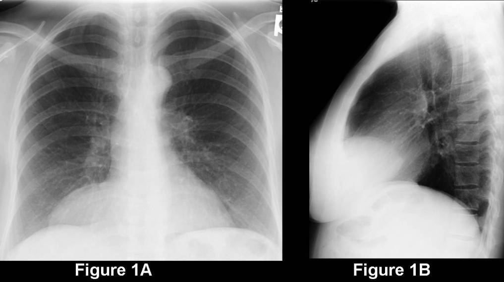 Radiograph 3 from archived case 67