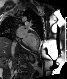 Radiograph 1 from archived case 42