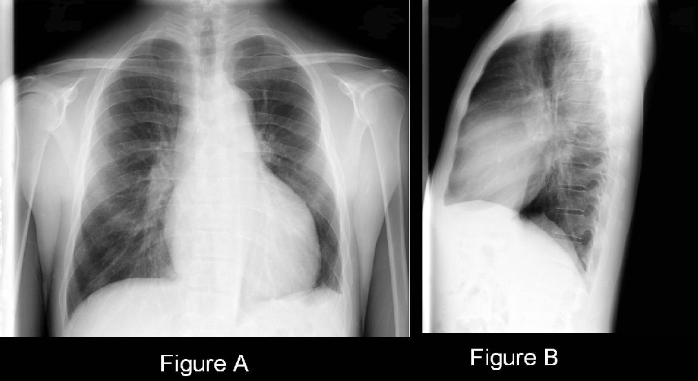 Radiograph 1 from archived case 40