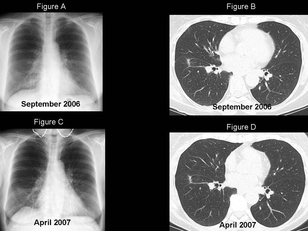 Radiograph 2 from archived case 47