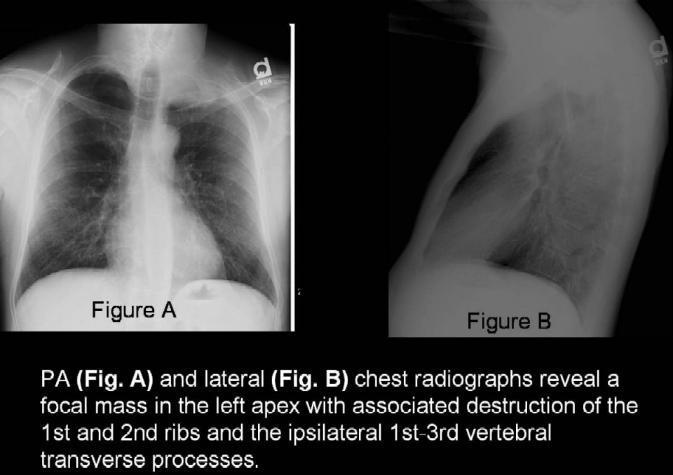 Radiograph 2 from archived case 28