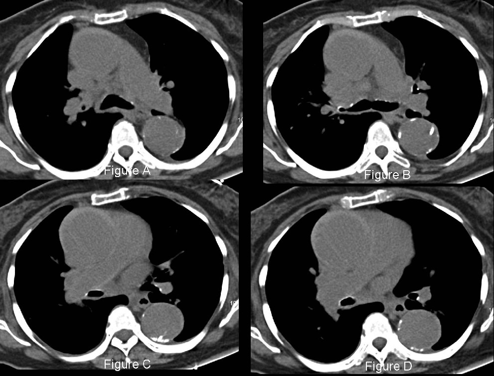 Radiograph 2 from archived case 25