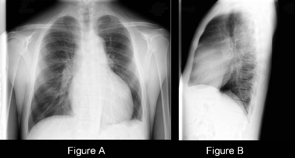 Radiograph 4 from archived case 40