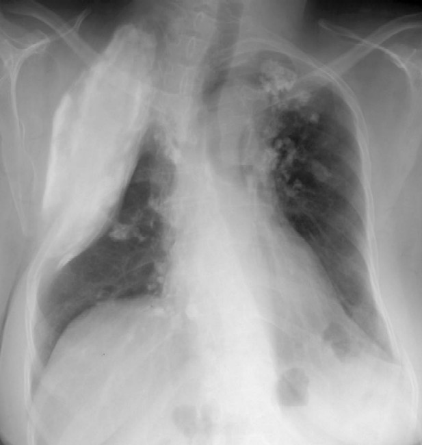 Radiograph 1 from archived case 29