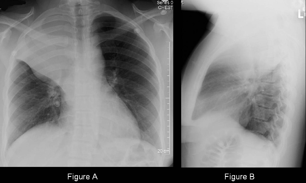 Radiograph 1 from archived case 24