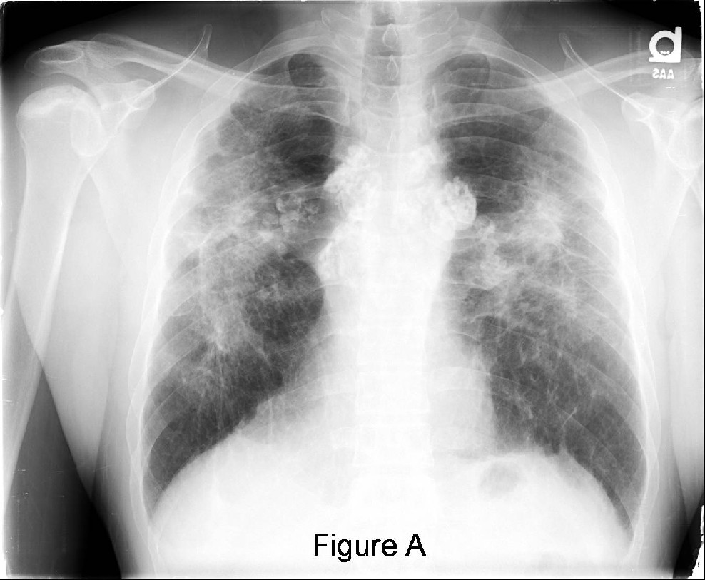 Radiograph 1 from archived case 21