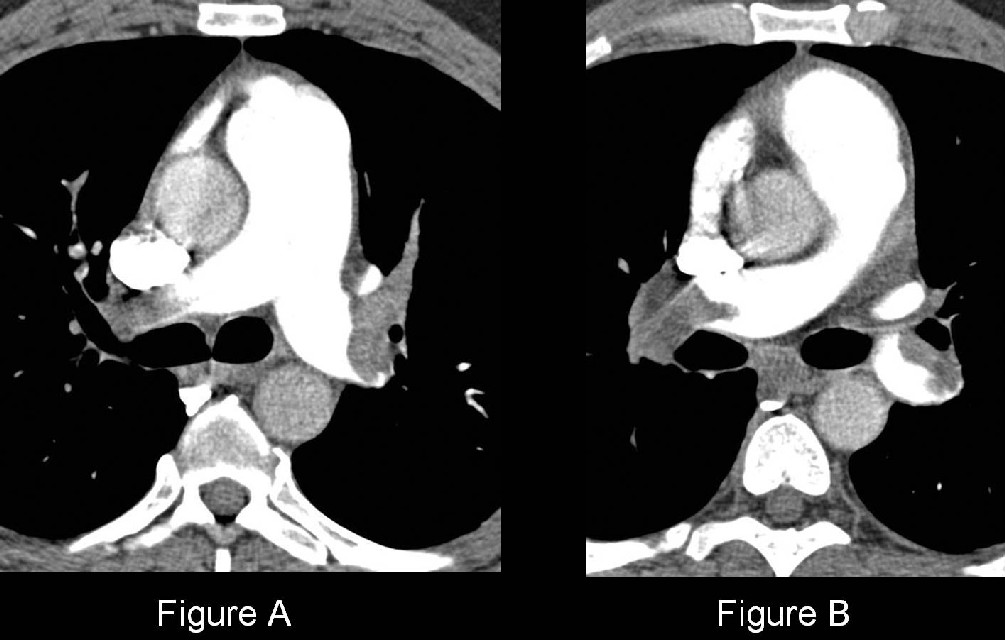 Radiograph 1 from archived case 41