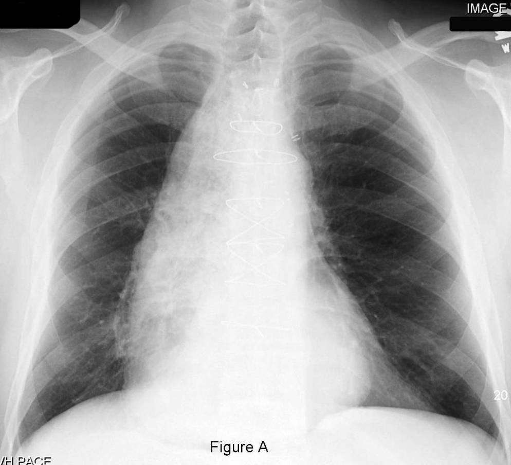 Radiograph 3 from archived case 45