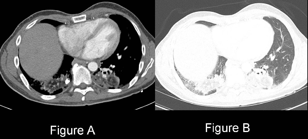 Radiograph 3 from archived case 14