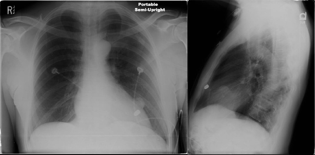 Radiograph 1 from archived case 15