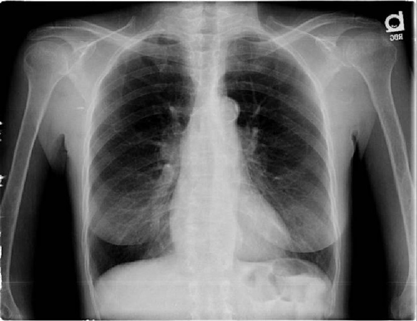 Radiograph 1 from archived case 11