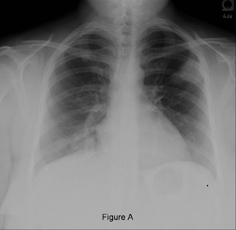 Radiograph 1 from archived case 33