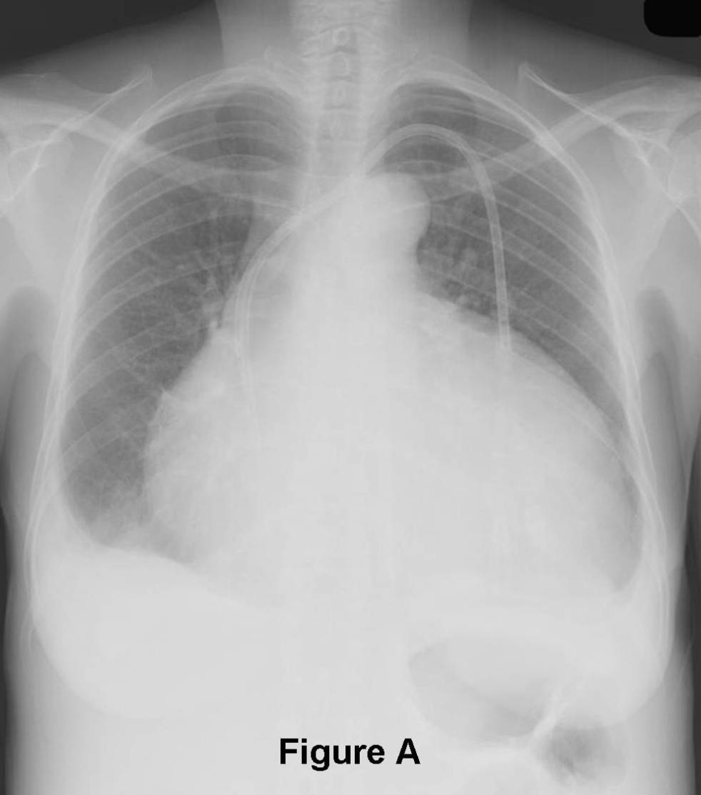 Radiograph 4 from archived case 52