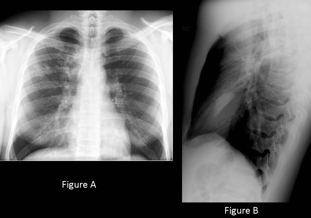 Radiograph 2 from archived case 48